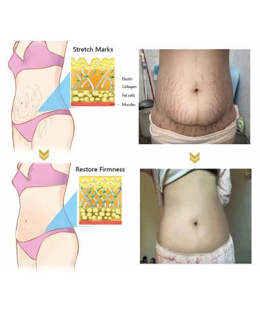 AWZLOVE Bee venom Comprehensive cream Bee Venom Skin Treatment Cream Effectively firms skin and reduces blemishes (2PCS) - Buy Online on GoSupps.com