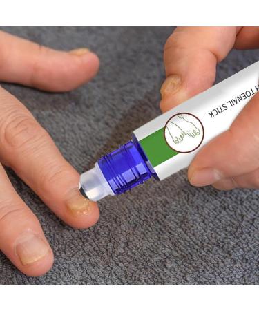  Mimoqk Nail Growth Toenail Repair Natural Nourishing Strengthening Stick Brittle Damaged Nails Toenail Medication Branch For Healthier Stronger Toenails 10ml - Buy Online on GoSupps.com