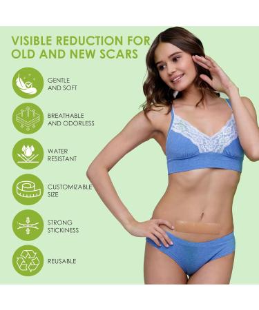 Buy AUSLKA Silicone Scar Sheets 1.6 x 120 Roll Professional Scar Tape for C-Section Tummy Tuck Keloid & Scar Treatments Fast International Shipping - Buy Online on GoSupps.com