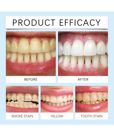 Mint Flavor Brightening Toothpaste Gentle Fresh Cleaning for Stain & Tartar Removal Daily Teeth Care Toothpaste(2PCS) - Buy Online on GoSupps.com