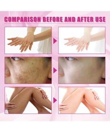 Extra Strength Yellow Peeling Oil | Exfoliating Solution for All Skin Types - Dark Skin Dead Skin Remover (3.87 Fl Oz / 110ML - Buy Online on GoSupps.com