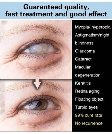 Eye Care Brightening Solution - 2023 Japanese Eye Drops for Clear Vision & Fatigue Relief (3 PCs) - Buy Online on GoSupps.com