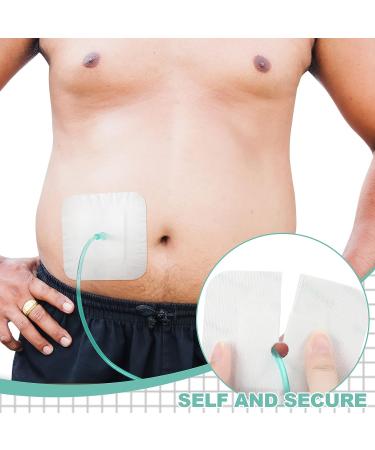 50 Pcs Feeding Tube Pads 4x4 inch - Adhesive Bandages for PD Catheter G Tubes - Dialysis Accessories and Supplies - Buy Online on GoSupps.com