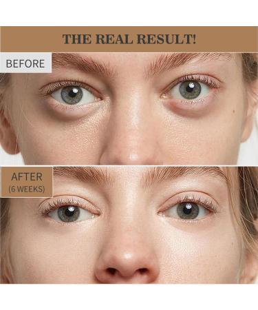 Retinol Eye Cream Instant Lift Plus Dark Circles Instant Lift Plus Poche Yeux Hydrating & Moisturizing Eye Cream Lightens Lines And Dark Circles Instantly Removes Bags Dark Circles - Buy Online on GoSupps.com