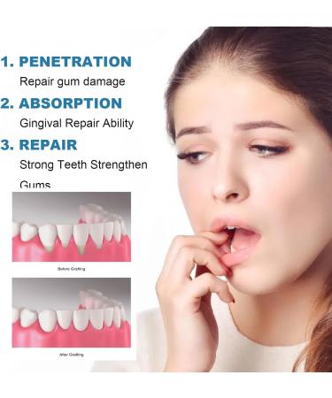 GNAUMORE Gum Regrowth Drops Gum Repair Gum Repair Children Drops Natural Oral Care Drops 30 ml x 2 pieces - Buy Online on GoSupps.com