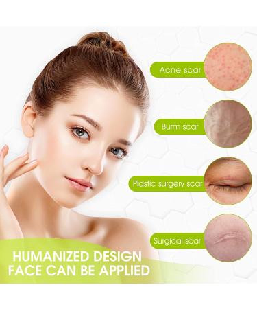 Silicone Scar Sheets 1.6 x 60 Roll - Effective Silicone Gel Tape for Scar Removal - C-Section, Keloid, Burn & Acne - 1.5M Roll - Buy Online on GoSupps.com