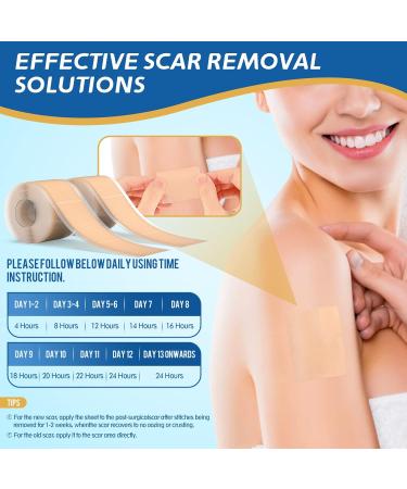 LONNIELONLI Silicone Scar Sheets - 2 Pack 1.6x60 Roll - Reusable Professional Scar Removal Tape for C-Section, Surgery, Burn, Keloid, Acne - Buy Online on GoSupps.com