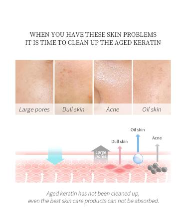 Chamomile Exfoliating Gel - Deep Cleansing Pore Tightening & Hydrating (60g) | Gentle Exfoliation for Improved Skin Tone - Buy Online on GoSupps.com