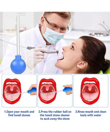 Tonsillenstein Remover | Effective Almond Stone Cupping Glass for Tonsil Stone Removal & Fresh Breath Oral Care - Buy Online on GoSupps.com