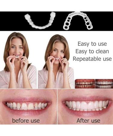 Ytxy Upper & Lower Teeth Veneers - Instant Whitening & Perfect Smile | Cosmetic Dentures & Oral Hygiene Tools - 2 Pairs - Buy Online on GoSupps.com