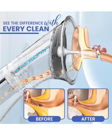 Ear Wax Removal - LED Display Electric Ear Cleaner - IPX7 Waterproof - Safe and Effective for Adults & Kids Family-Friendly - Easy to Use - Includes 6-Piece Ear Cleaning Kit - Buy Online on GoSupps.com
