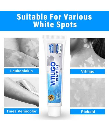 Effective Vitiligo Treatment Cream | Restore Skin Pigmentation & Reduce Fading - Buy Online on GoSupps.com