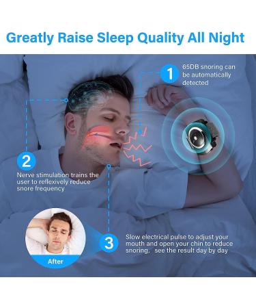 Sleep Connection Anti-Snore Wristband - Effective Snoring Solution for Blocked Nostrils - Snore Reduction - 1 Count (Black) - Buy Online on GoSupps.com