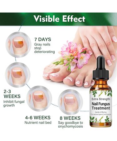 Fungal Nail Treatment 30ML - Extra Strong Solution for Toenails & Fingernails - Restores Healthy Nails - Protects Thick, Broken, and Discolored Nails - Green-1 - Buy Online on GoSupps.com