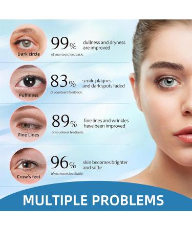 Allony Instant Eye Cream Tightener Eye Tightening Cream Instant Tightening Eye Cream Eye Wrinkle Cream Iinstant Results 30ml*2 - Buy Online on GoSupps.com