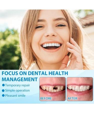 Temporary Tooth Filling Tooth Repair Kit with Tweezers DIY Temporary Tooth Repair Beads Teeth Replacement for Temporary Restoration of Missing & Broken Teeth Replacement Dentures 30ml - Buy Online on GoSupps.com