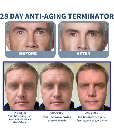 TBeautfave Retinol Serum for Men High Strength Anti-Aging Serum with Hyaluronic Acid Retinol Moisturiser Serum Face Serum for Fine Line and Wrinkles Skin Repair Serums Skincare - Buy Online on GoSupps.com