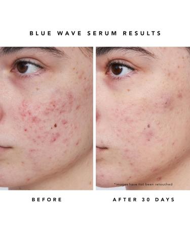 HERBIVORE Blue Besties Duo | Acne Treatment - Aquarius Cleanser & Blue Wave Serum | Vegan Cruelty-Free Plant-Based - Buy Online on GoSupps.com
