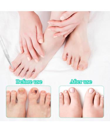 TECHEEL Nail Pen Cuticle Oil Pen Nail Nutrition Oil Pen Nail Care Nail Treatment Pen Nail Care Pen for Repairing Cracked and Dry Nails - Buy Online on GoSupps.com