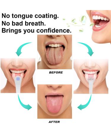 Professional Tongue Scraper Cleaner for Reducing Bad Breath Stainless Steel Tongue Cleaner with 2 Replaceable Tongue Brush - Buy Online on GoSupps.com