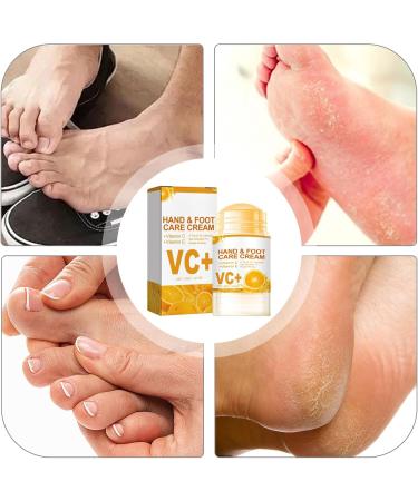 Hand Cream Rough Foot Care Cream Foot Cream For Cracked Heel Moisturizer Cream for Hand and Foot 40g Natural Nourishing Hand and Foot Care Cream Deep Hydrating & Smooth Dull Skin - Buy Online on GoSupps.com