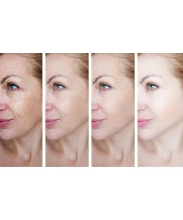 Intimate Area Cream for Dark Skin - Brightening Cream for Underarms & Sensitive Areas | 30ML | Skin Lightening Solution - Buy Online on GoSupps.com