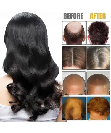 Hair Growth Wand Haute frequence baguette pour la croissance des cheveux Baguette de croissance des cheveux avec hair serum Baguette de croissance des cheveux avec 4 tubes diff rents (1 Vert) 1 Vert - Buy Online on GoSupps.com