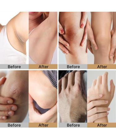 Underarm Detox Scrub with Charcoal & Peppermint - Deep Cleansing Exfoliating Body Scrub for Long-Lasting Freshness & Odor Relief - International Shipping Available - Buy Online on GoSupps.com