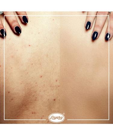 Turmeric Soap: Hand Crafted Vegan Ayurvedic Bar Soap - Pack of 12 Bars (31.7 Oz) - Buy Online on GoSupps.com