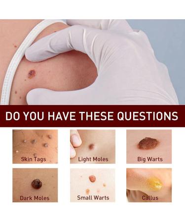 ZHBiwmatn 2024 New 5Pcs Wipe Off and Extreme Skin Wipe Off & Fast Easy to for Face Armpit Flesh Neck 3ml - Buy Online on GoSupps.com