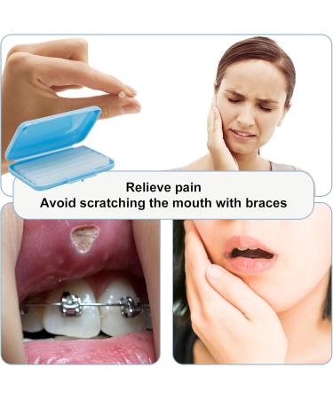 Dental Wax for Braces - Multicolor Orthodontic Wax with Fruit Smell | Oral Care Orthodontics Wax for Brace Wearers - Buy Online on GoSupps.com