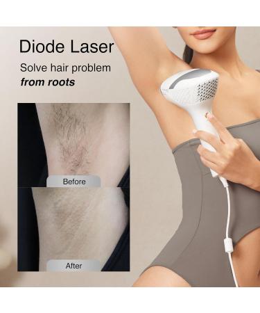V8S Diode Laser Hair Removal Device for Men & Women - FDA-Cleared Permanent Hair Reduction for Skin Tone 1-5 810nm Wide-Angle Technology - Buy Online on GoSupps.com