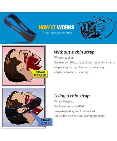 Adjustable Anti-Snoring Chin Strap for Men and Women - Effective Snoring Reduction Aid for Better Sleep - Buy Online on GoSupps.com
