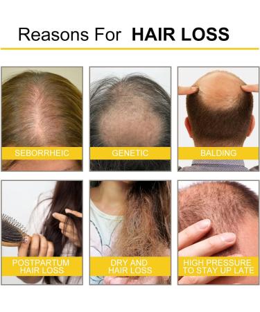 Ginger Hair Serum Natural Ginger Hair Density Oil Ginger Hair Revitalizing Serum Anti Frizz Hair Serum Regenerating Serum for Thinning and - Buy Online on GoSupps.com