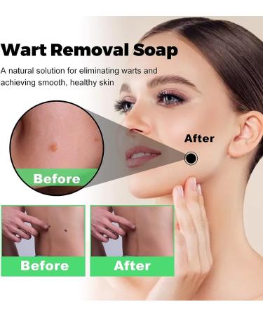 (100% Effective) 2PCS SmoothSkin Soap | Natural Aloe Vera Soap | Natural Smoothskin Soap | Moisturizing Instant Blemish Soap for All Skin Type | 100g/3.52fl.oz - Buy Online on GoSupps.com