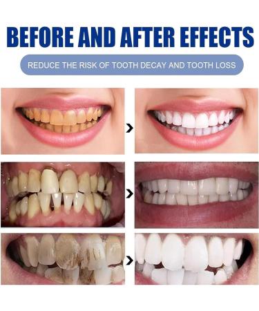 Face U Toothpaste Face U Baking Soda Peppermint Toothpaste Face U Teeth Whitening Toothpaste Freshens Breath Tartar Removal Deep Cleansing Teeth (2pcs) - Buy Online on GoSupps.com