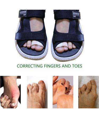 Niupiour Fabric Hammer Toe Wraps - 8 Pack Toe Bandages Protectors & Braces for Overlapping, Crooked, Curled, and Bent Toes - Toe Splints & Separators for Broken Toes - Buy Online on GoSupps.com
