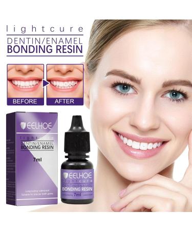 Tooth Jewelry Gemkit - Professional DIY Tooth Gemstone Kit for Stunning Tooth Decoration | Complete Teeth Gems Kit with Lamp & Glue - Buy Online on GoSupps.com