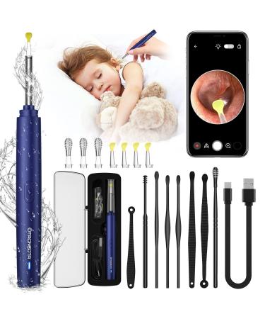 OTAONEOTA Ear Wax Removal Tool  Ear Wax Cleaner Compatible with iPhone  iPad  and Android(Blue) Deep Blue