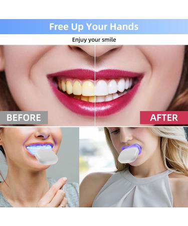 Professional Teeth Whitening Kit - Gel Pen Strips 32X LED Light Charging Case & Desensitizing Gel - Brighten Your Smile Anywhere - Buy Online on GoSupps.com