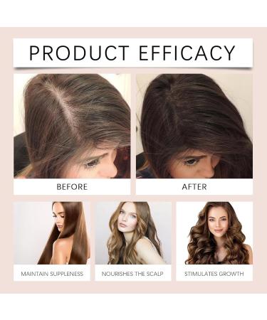 Golab Beauty Scalp Strengthening Massage Oil Golabbeauty Hair Growth Oil for Women for Thicker Fuller Healthier Hair (1Pc) - Buy Online on GoSupps.com