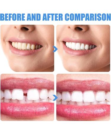 Buy 2 Pairs Instant Veneer Prostheses - Comfortable & Natural Fake Teeth for Men & Women | Artificial Teeth Solutions - Buy Online on GoSupps.com