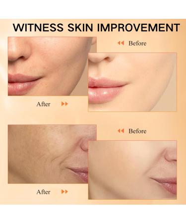 Vitamin C Serum - Vitamin C Serum for Face - Face Serum for Women - Hydrating Serum with Hyaluronic Acid & Vitamin E - Brighten & Plump Skin - Anti Aging & Wrinkle Face Serum 50ml - Buy Online on GoSupps.com