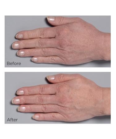 Perricone MD Cold Plasma Plus+ Hand Therapy - Intense Hydration & Anti-Aging Formula 2 fl. oz. - Shop Internationally - Buy Online on GoSupps.com