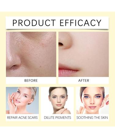 Hydrating Toner For Face - Moisturizing & Soothing Daily Facial Care To Nourish Skin & Reduce Dryness/Peeling(1PCS) - Buy Online on GoSupps.com