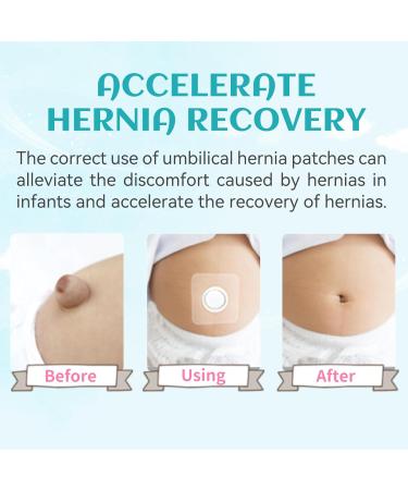 Buy Baby Belly Navel Patches - 15 Pieces Waterproof Cotton Pads for Umbilical Hernia | Belly Button Shaper & Wrap - 8x8cm - Buy Online on GoSupps.com