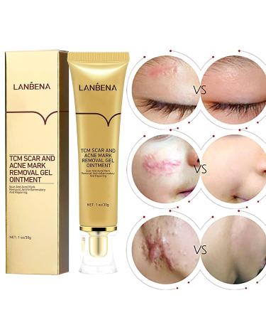 Advanced Scar Removal Cream for Men - Moisturizing Solution for Stretch Marks and Dark Spots - One Size Fits All - Buy Online on GoSupps.com