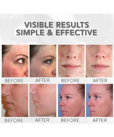 Angel Kiss LED Face Mask Light Therapy - 7 Color Blue & Red Light for Anti-Aging Skin Care | Facial Treatment Photon Mask for Wrinkle Removal & Skin Rejuvenation - Best Gift for Women - Buy Online on GoSupps.com