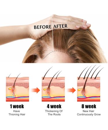 Black Castor Oil for Eyelashes and Eyebrow Growth 60ML Cold Pressed Castor Oil for Hair Growth Nails & Skin Promote Hair Growth Strengthen Hair Roots and Prevent Bifurcation - Buy Online on GoSupps.com