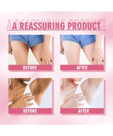 100g Intimate Area Skin Whitening Cream whitening cream dark spot remover for body underarm whitening cream skin repair 2 pieces 2PC - Buy Online on GoSupps.com